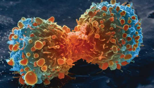 Cancer Cells Play It Dirty To Get What They Want
